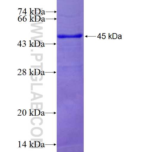 MPHOSPH6 fusion protein Ag1080 SDS-PAGE