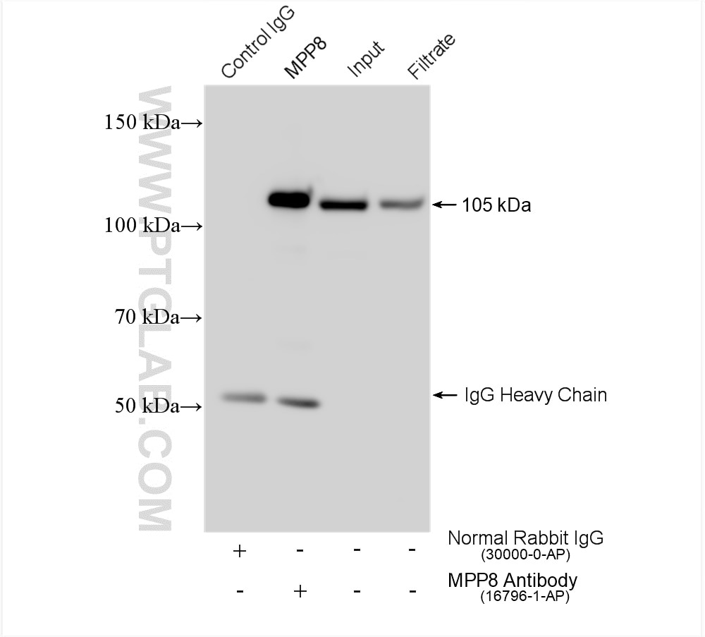 Immunoprecipitation (IP) experiment of HEK-293 cells using MPP8 Polyclonal antibody (16796-1-AP)