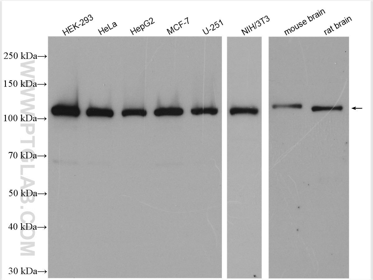 Western Blot (WB) analysis of various lysates using MPP8 Polyclonal antibody (16796-1-AP)