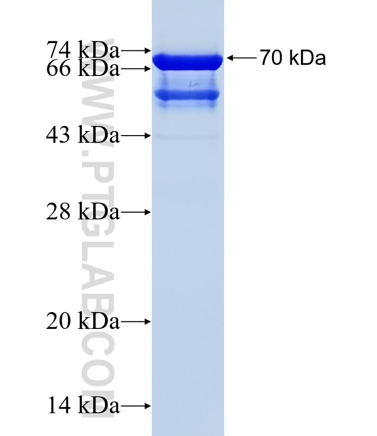 MPHOSPH8 fusion protein Ag10268 SDS-PAGE