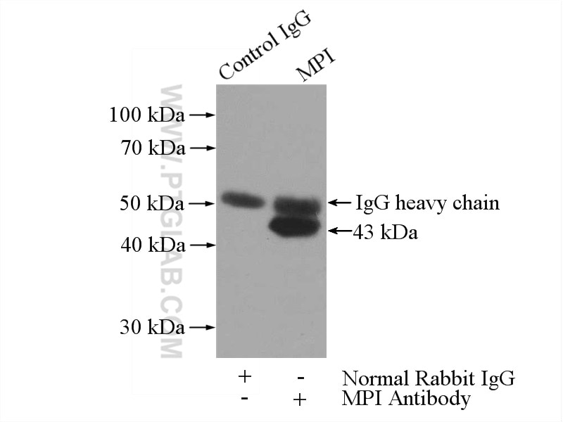 Immunoprecipitation (IP) experiment of mouse brain tissue using MPI Polyclonal antibody (14234-1-AP)