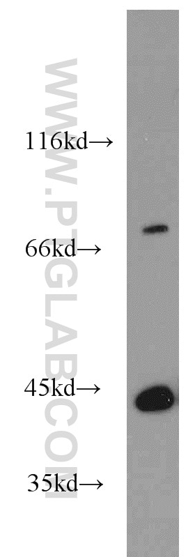 Western Blot (WB) analysis of human brain tissue using MPI Polyclonal antibody (14234-1-AP)