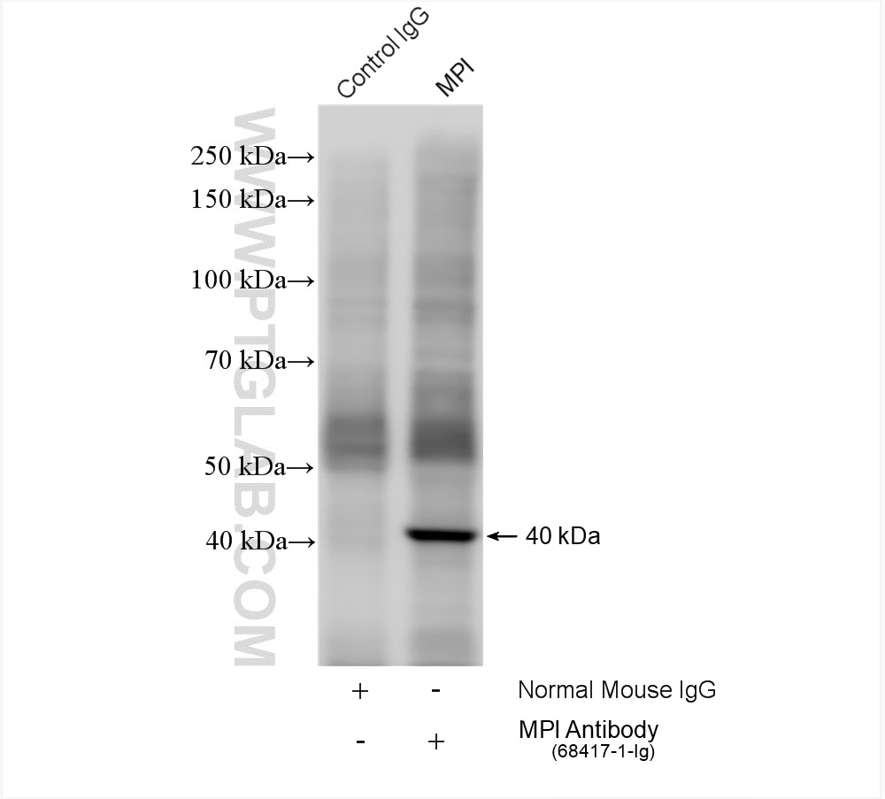 Immunoprecipitation (IP) experiment of Jurkat cells using MPI Monoclonal antibody (68417-1-Ig)