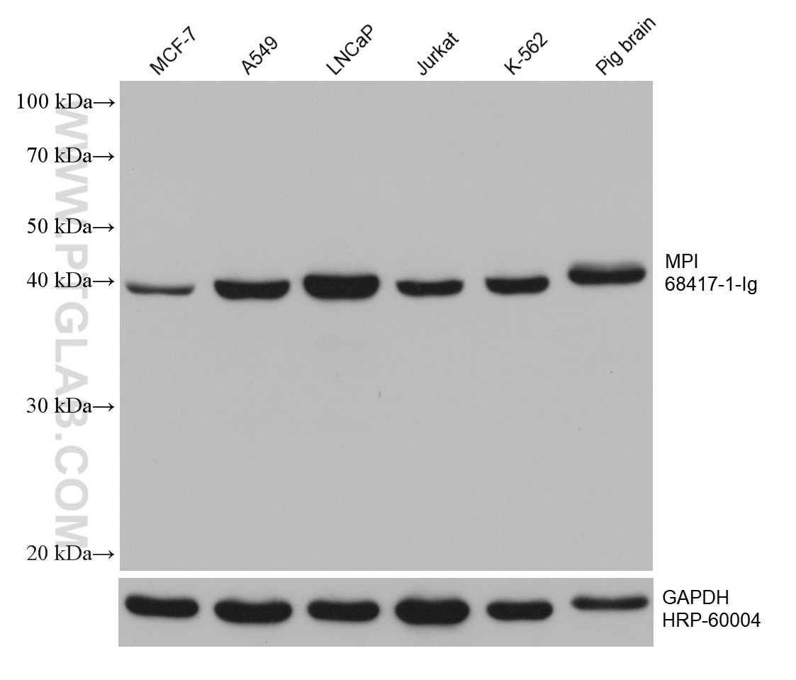 Western Blot (WB) analysis of various lysates using MPI Monoclonal antibody (68417-1-Ig)