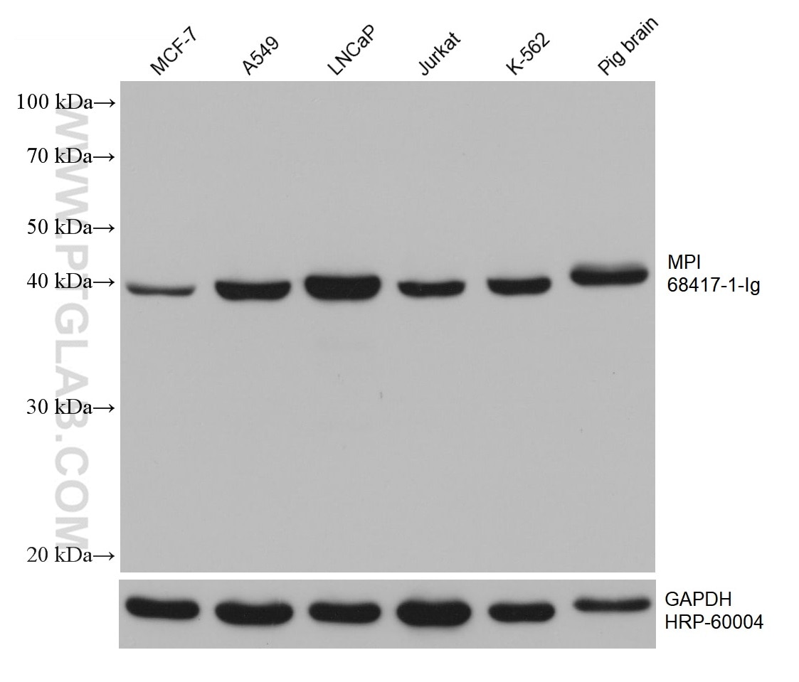 WB analysis using 68417-1-Ig