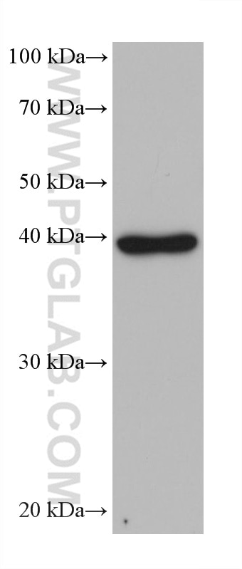 Western Blot (WB) analysis of rat brain tissue using MPI Monoclonal antibody (68417-1-Ig)