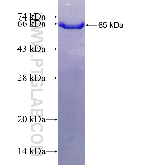 MPI fusion protein Ag5475 SDS-PAGE
