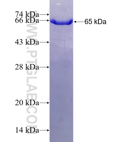 MPI fusion protein Ag5475 SDS-PAGE