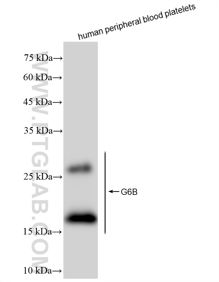 Western Blot (WB) analysis of various lysates using MPIG6B Recombinant monoclonal antibody (88167-2-RR)