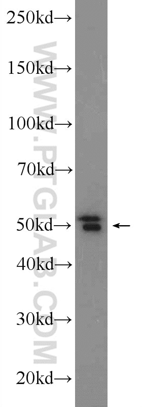 Western Blot (WB) analysis of SMMC-7721 cells using MPND Polyclonal antibody (24420-1-AP)