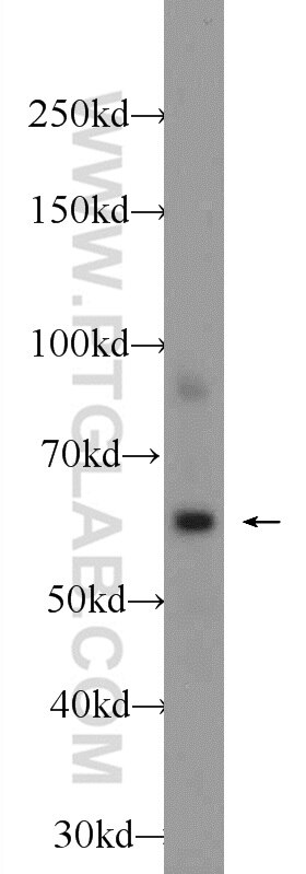 Western Blot (WB) analysis of mouse liver tissue using MPND Polyclonal antibody (24420-1-AP)
