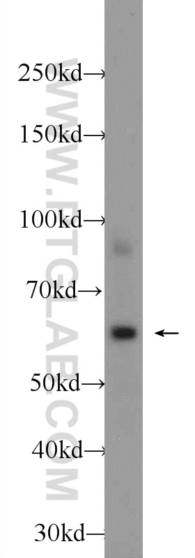 Western Blot (WB) analysis of mouse liver tissue using MPND Polyclonal antibody (24420-1-AP)