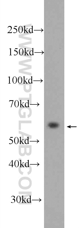 Western Blot (WB) analysis of SMMC-7721 cells using MPND Polyclonal antibody (24420-1-AP)