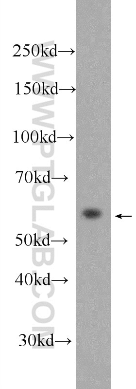 WB analysis of SMMC-7721 using 24420-1-AP