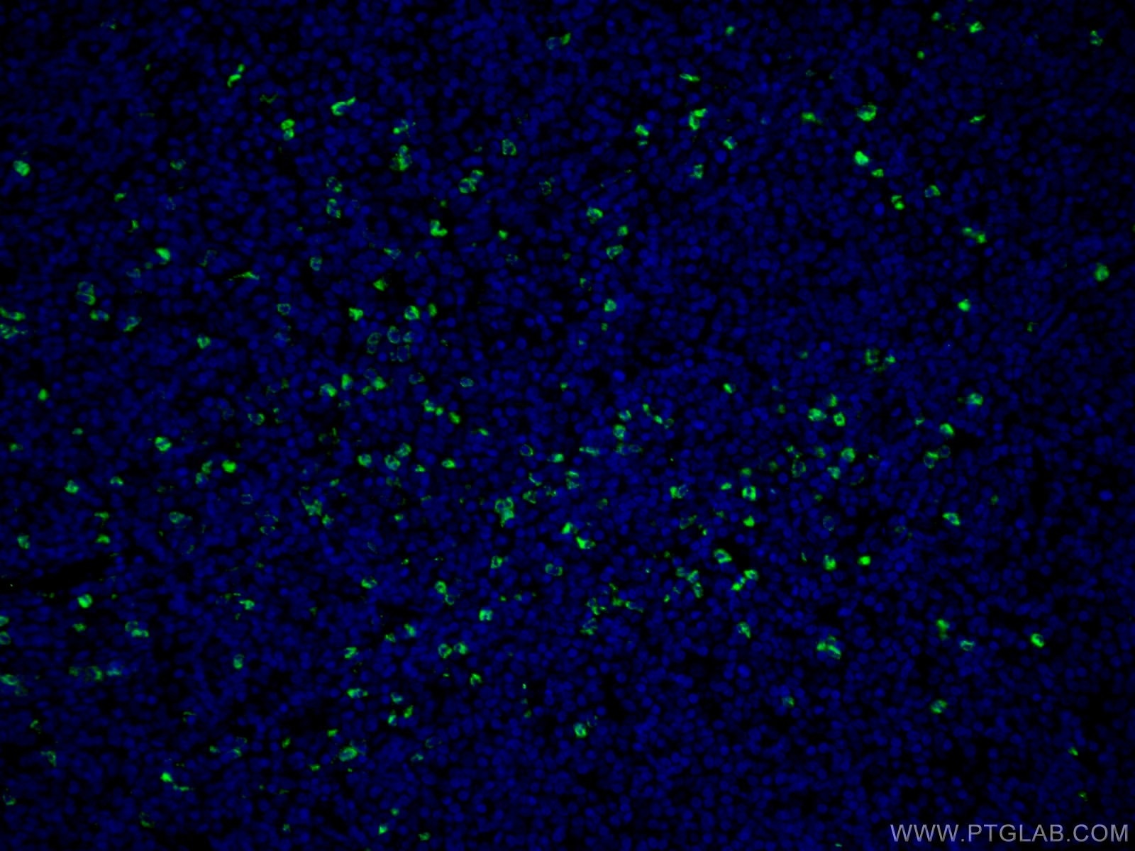 Immunofluorescence (IF) / fluorescent staining of human tonsillitis tissue using MPO Polyclonal antibody (22225-1-AP)