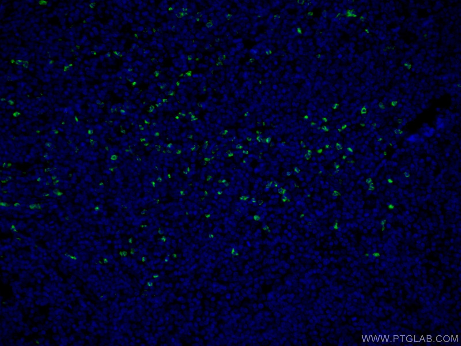 Immunofluorescence (IF) / fluorescent staining of human tonsillitis tissue using MPO Polyclonal antibody (22225-1-AP)