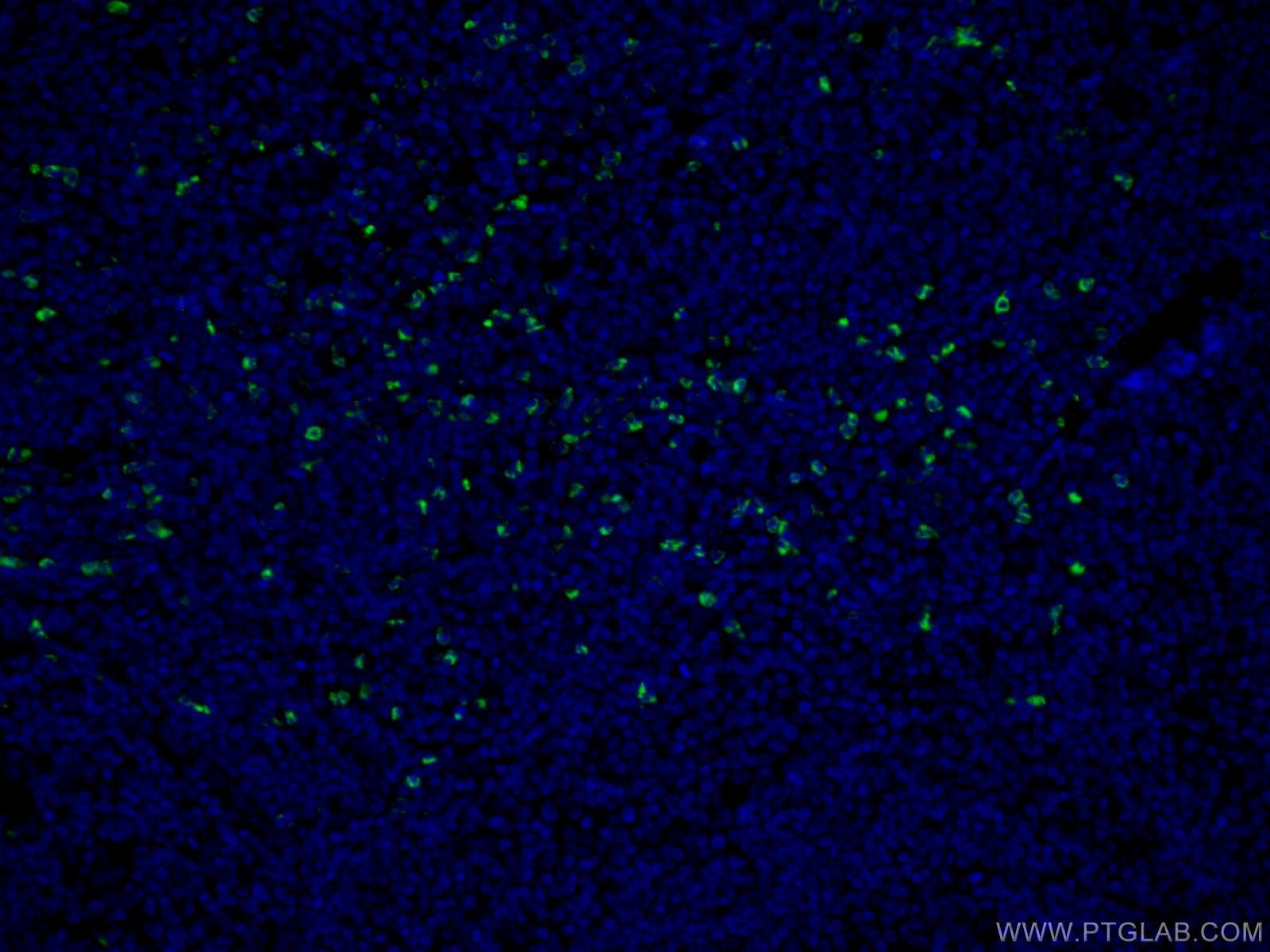 IF Staining of human tonsillitis using 22225-1-AP