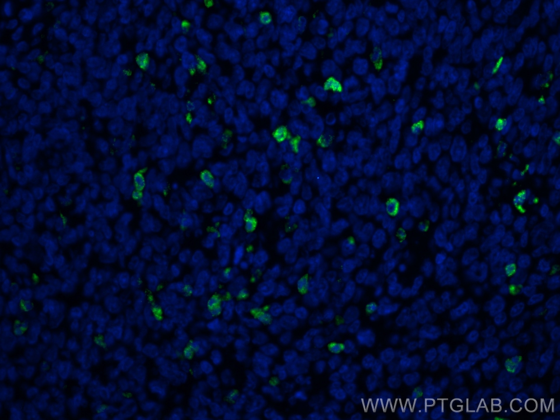 Immunofluorescence (IF) / fluorescent staining of human tonsillitis tissue using MPO Polyclonal antibody (22225-1-AP)