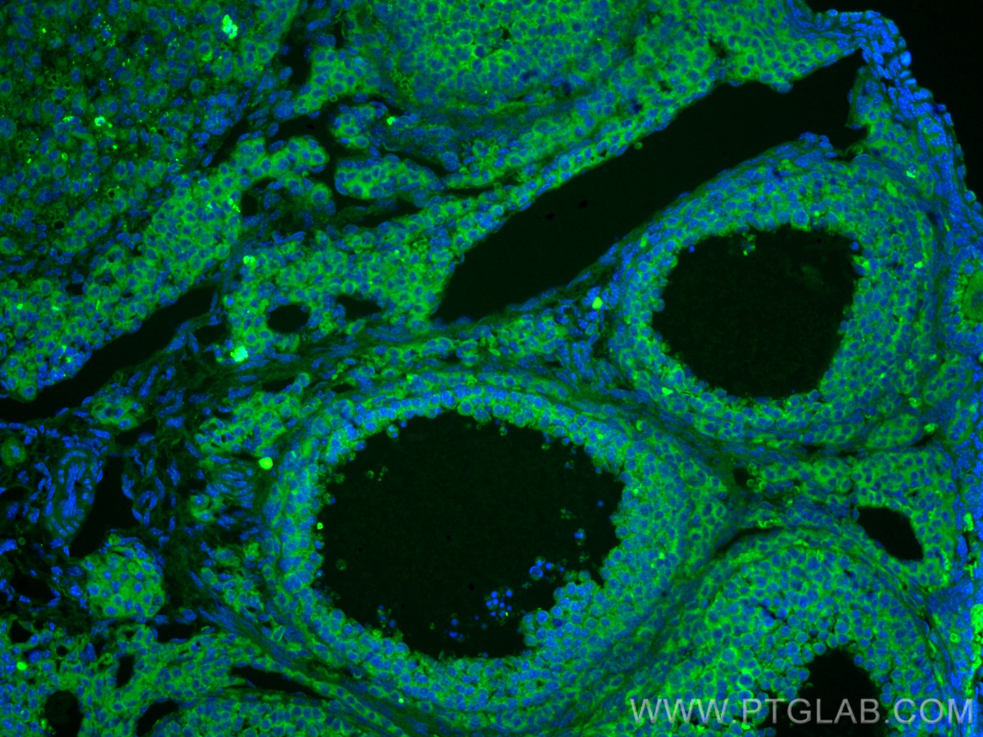 Immunofluorescence (IF) / fluorescent staining of mouse ovary tissue using MPO Polyclonal antibody (22225-1-AP)