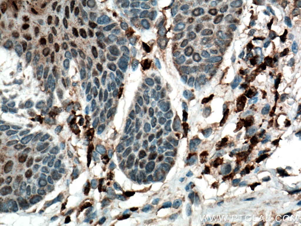 Immunohistochemistry (IHC) staining of mouse colon tissue using MPO Polyclonal antibody (22225-1-AP)