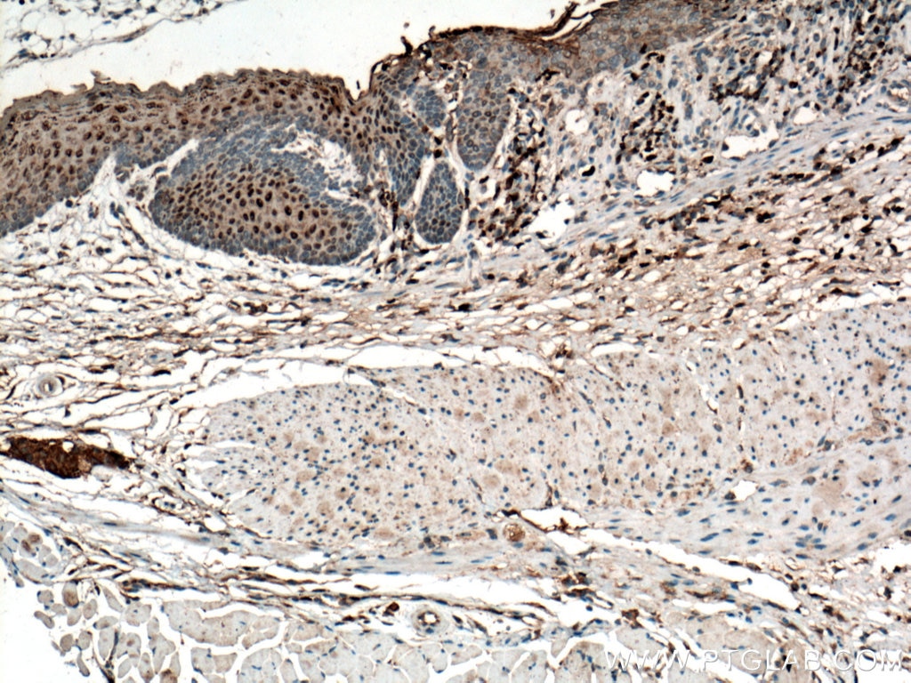 Immunohistochemistry (IHC) staining of mouse colon tissue using MPO Polyclonal antibody (22225-1-AP)