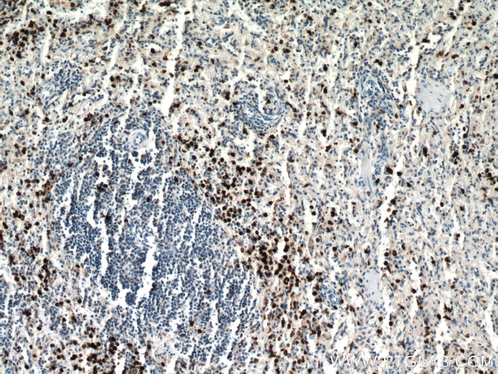 Immunohistochemistry (IHC) staining of human spleen tissue using MPO Polyclonal antibody (22225-1-AP)