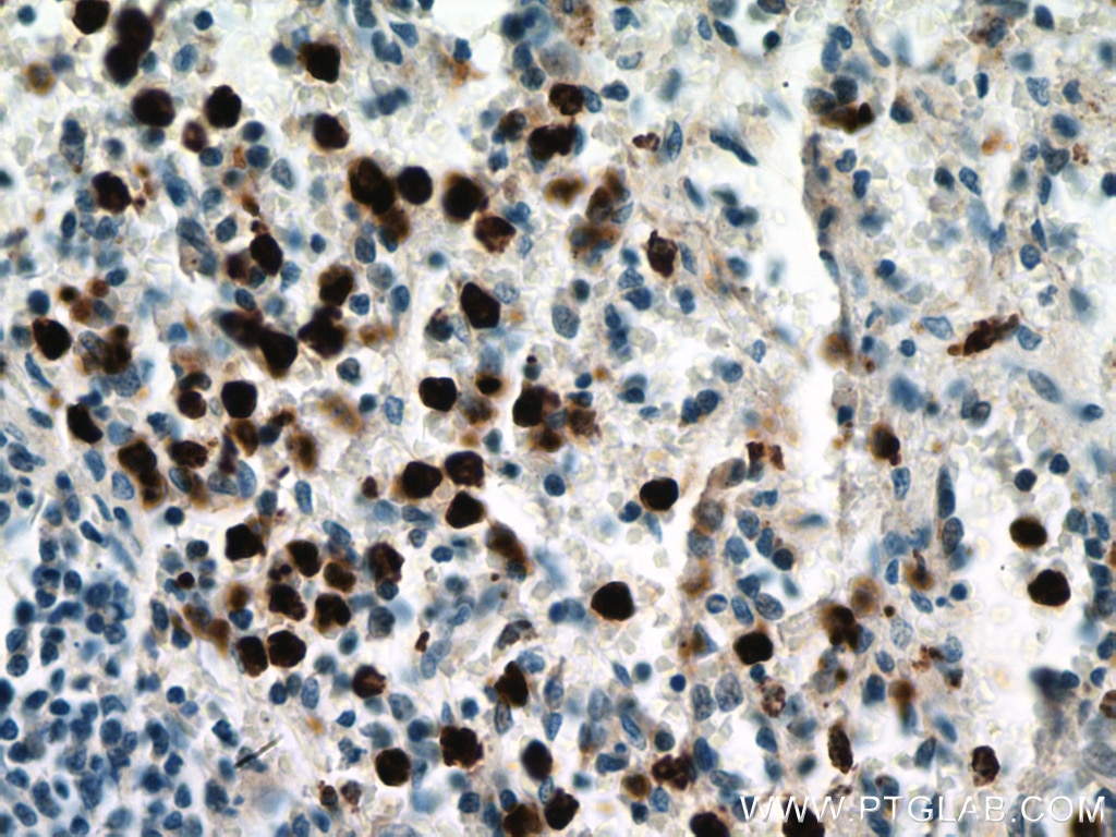 Immunohistochemistry (IHC) staining of human spleen tissue using MPO Polyclonal antibody (22225-1-AP)