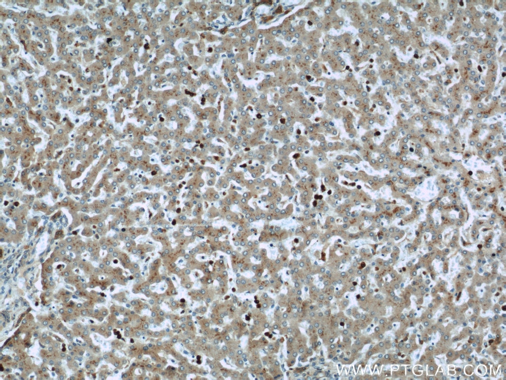 Immunohistochemistry (IHC) staining of human liver tissue using MPO Polyclonal antibody (22225-1-AP)