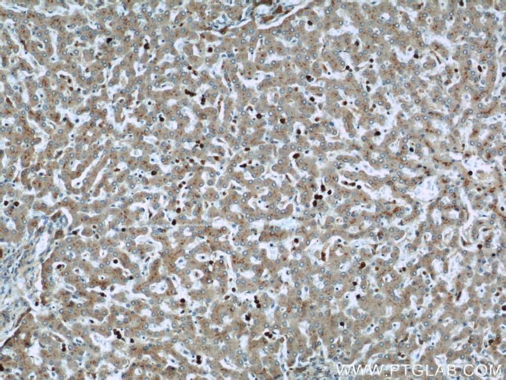 IHC staining of human liver using 22225-1-AP