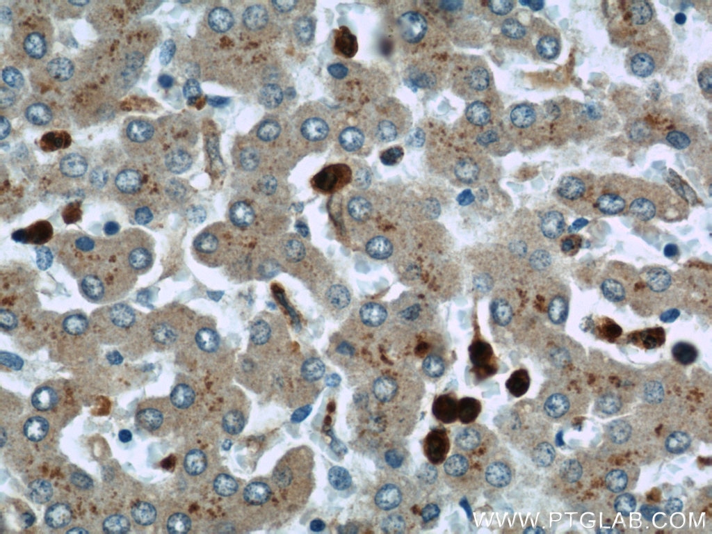 IHC staining of human liver using 22225-1-AP