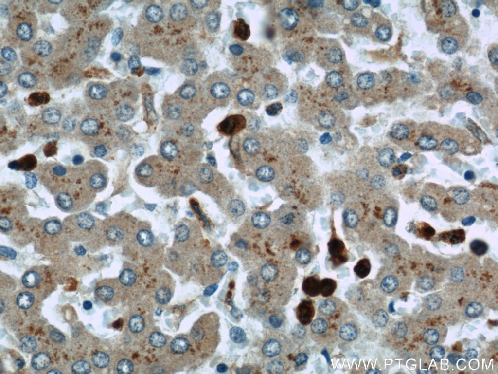 Immunohistochemistry (IHC) staining of human liver tissue using MPO Polyclonal antibody (22225-1-AP)