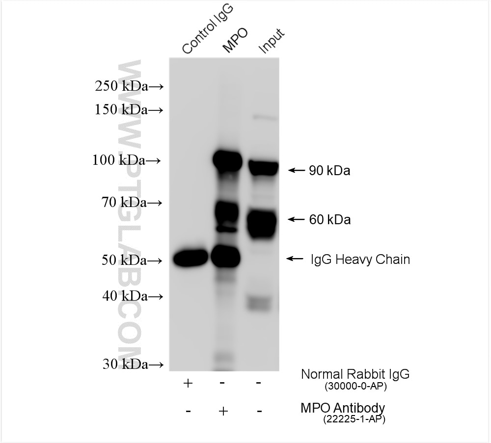 Immunoprecipitation (IP) experiment of HL-60 cells using MPO Polyclonal antibody (22225-1-AP)