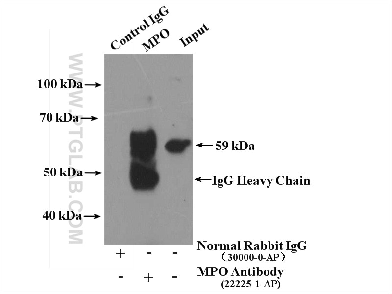 Immunoprecipitation (IP) experiment of HeLa cells using MPO Polyclonal antibody (22225-1-AP)
