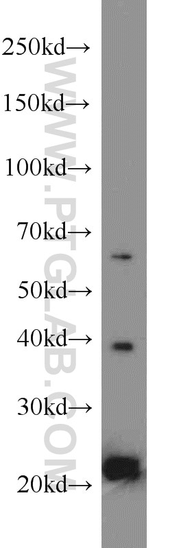 Western Blot (WB) analysis of U-937 cells using MPO Polyclonal antibody (22225-1-AP)
