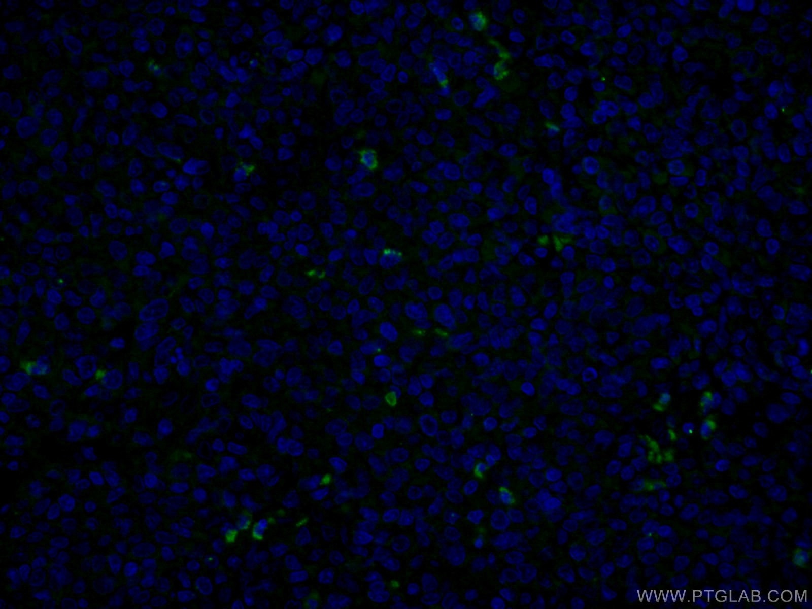 Immunofluorescence (IF) / fluorescent staining of human tonsillitis tissue using MPO Monoclonal antibody (66177-1-Ig)
