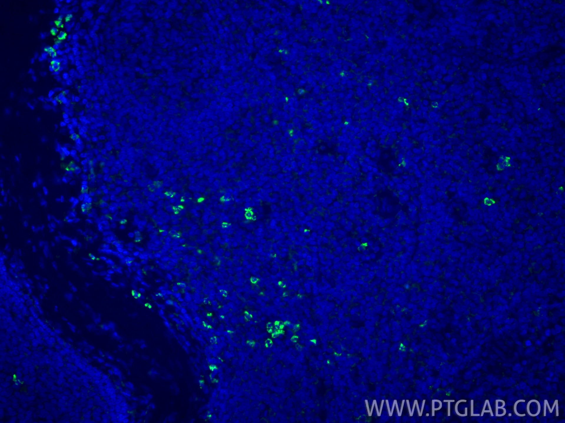 Immunofluorescence (IF) / fluorescent staining of human tonsillitis tissue using MPO Monoclonal antibody (66177-1-Ig)