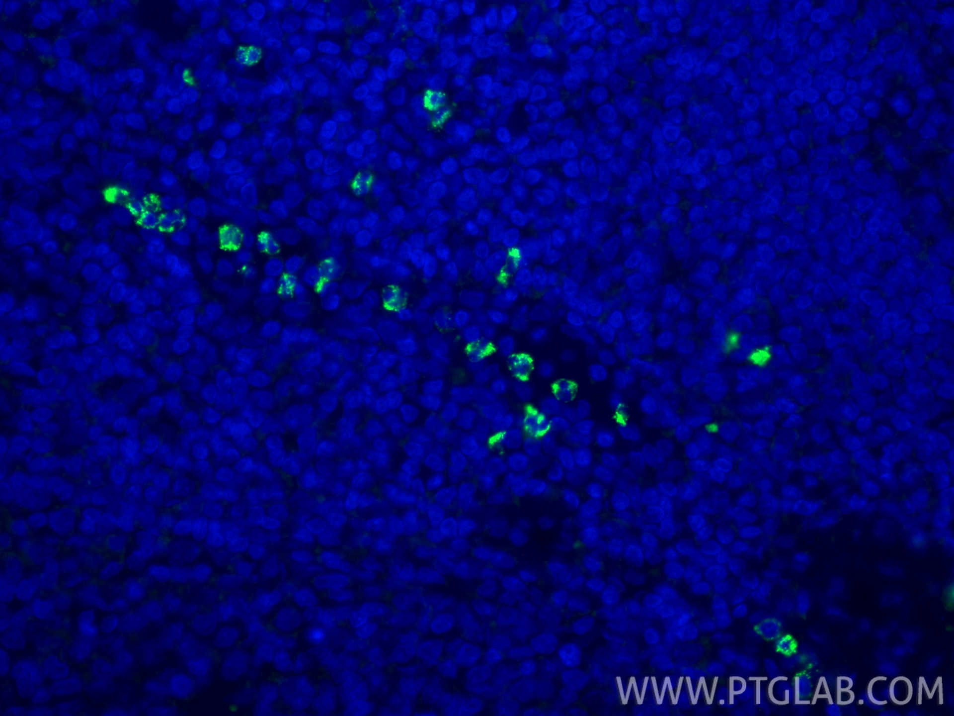 Immunofluorescence (IF) / fluorescent staining of human tonsillitis tissue using MPO Monoclonal antibody (66177-1-Ig)
