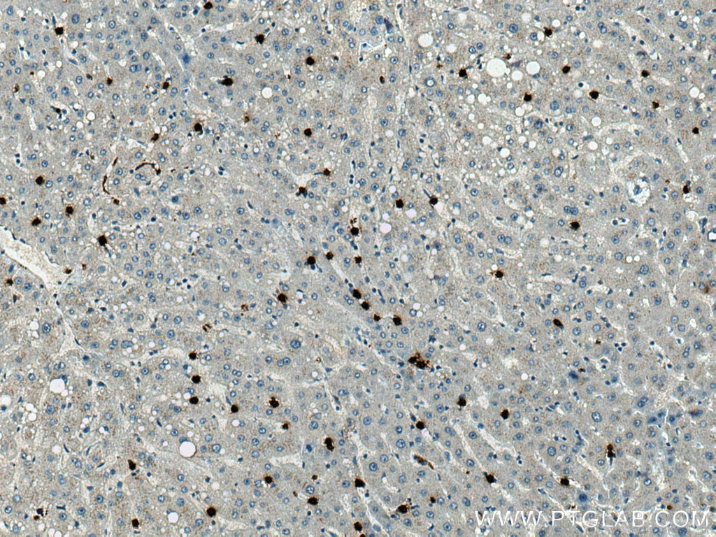 IHC staining of human liver using 66177-1-Ig