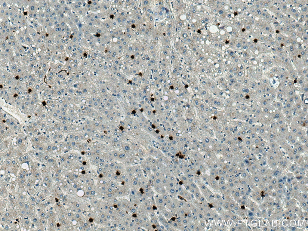 Immunohistochemistry (IHC) staining of human liver tissue using MPO Monoclonal antibody (66177-1-Ig)