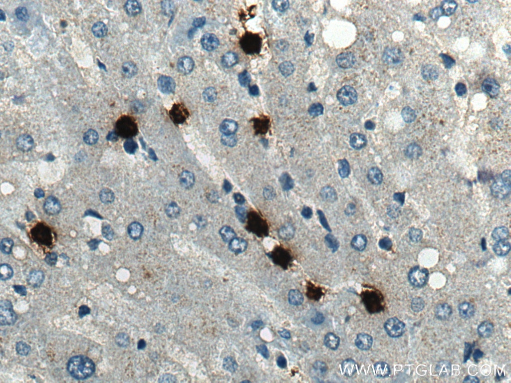 Immunohistochemistry (IHC) staining of human liver tissue using MPO Monoclonal antibody (66177-1-Ig)