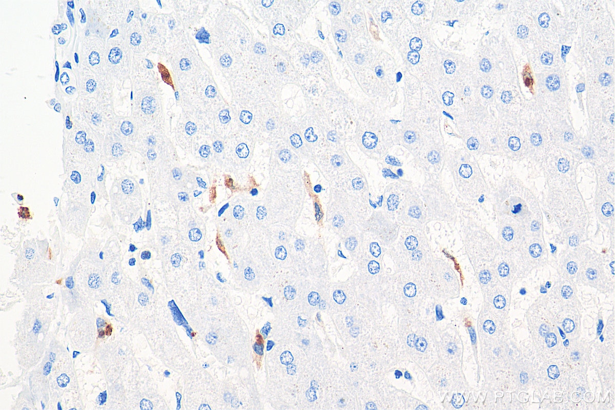 Immunohistochemistry (IHC) staining of human liver tissue using MPO Monoclonal antibody (66177-1-Ig)