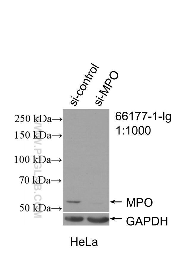 Western Blot (WB) analysis of HeLa cells using MPO Monoclonal antibody (66177-1-Ig)