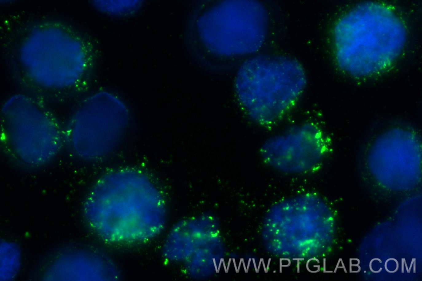 Immunofluorescence (IF) / fluorescent staining of HL-60 cells using MPO Recombinant antibody (81610-1-RR)