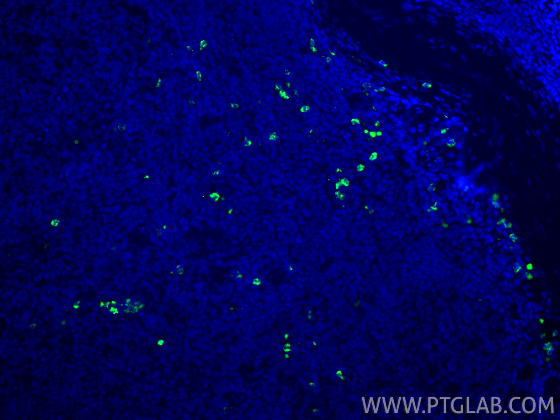 Immunofluorescence (IF) / fluorescent staining of human tonsillitis tissue using MPO Recombinant monoclonal antibody (81610-1-RR)