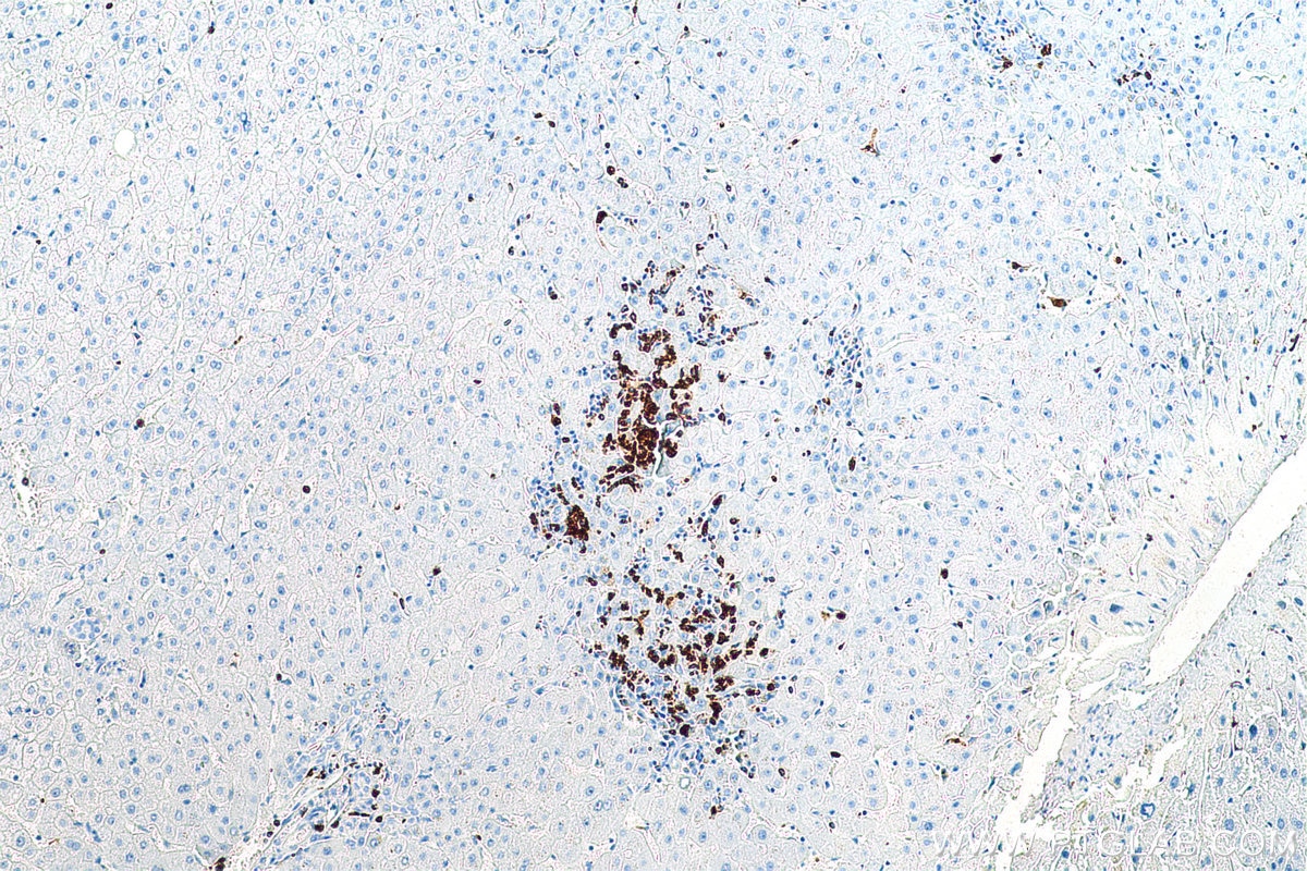 Immunohistochemistry (IHC) staining of human liver tissue using MPO Recombinant antibody (81610-1-RR)