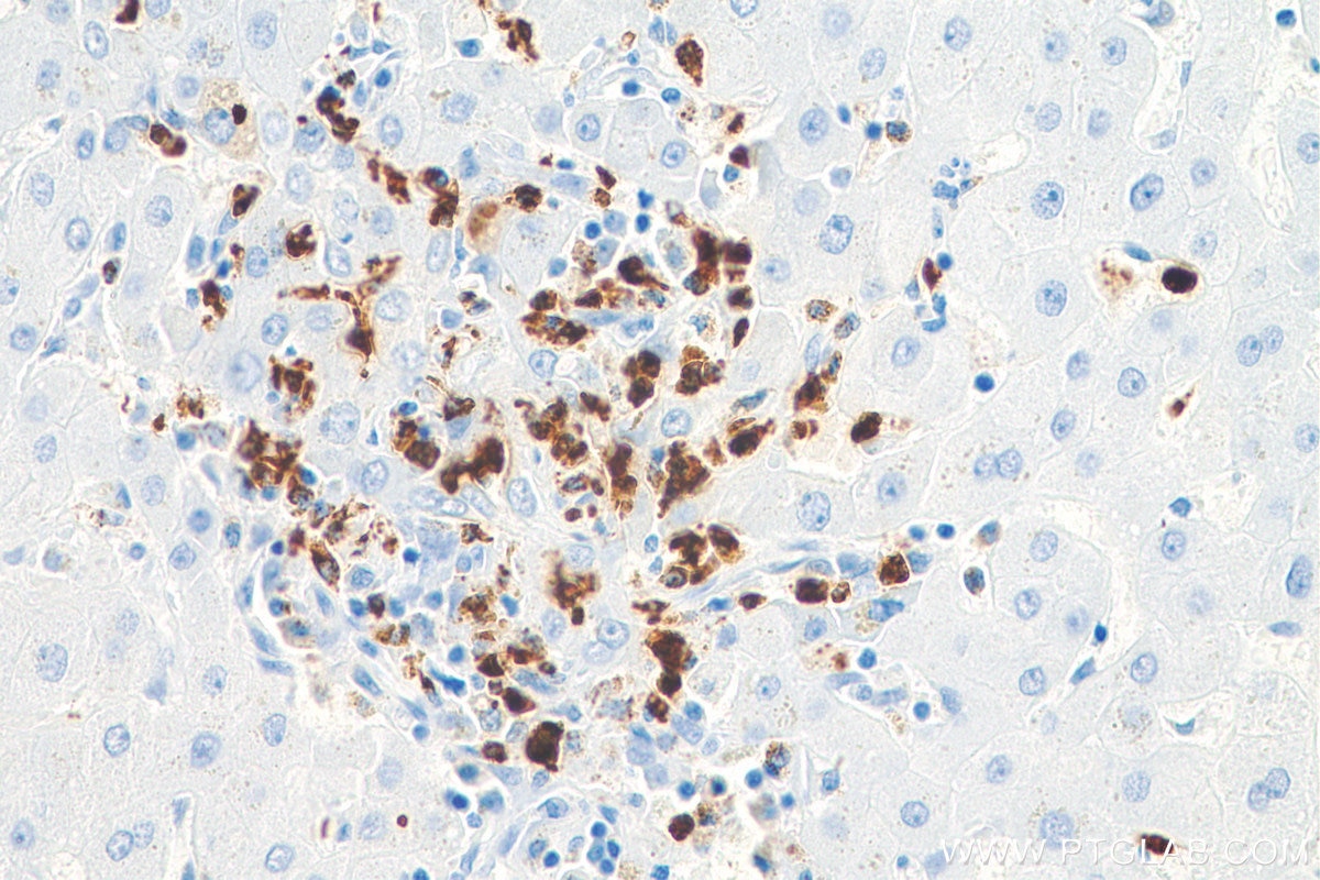 Immunohistochemistry (IHC) staining of human liver tissue using MPO Recombinant antibody (81610-1-RR)