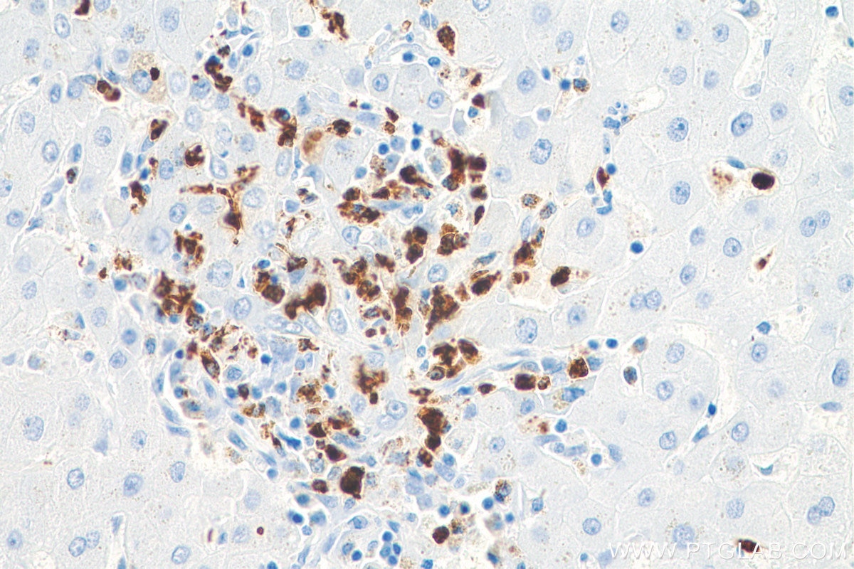 IHC staining of human liver using 81610-1-RR