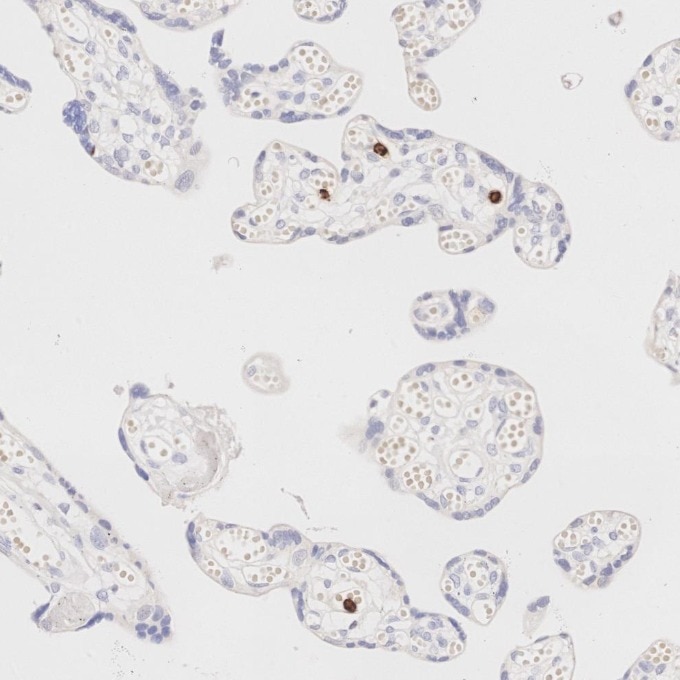 IHC staining of human placenta using 81610-1-RR Immunohistochemistry (IHC) staining of human placenta tissue using MPO Recombinant monoclonal antibody (81610-1-RR)