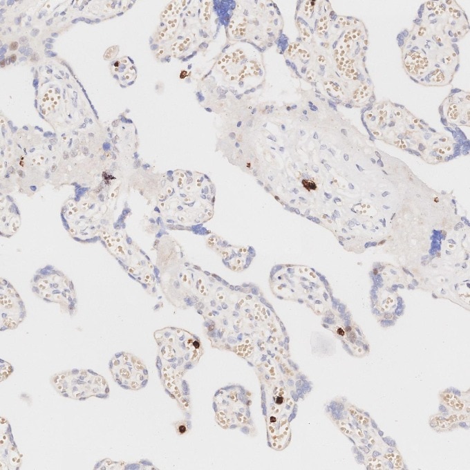 IHC staining of human placenta using 81610-1-RR Immunohistochemistry (IHC) staining of human placenta tissue using MPO Recombinant monoclonal antibody (81610-1-RR)