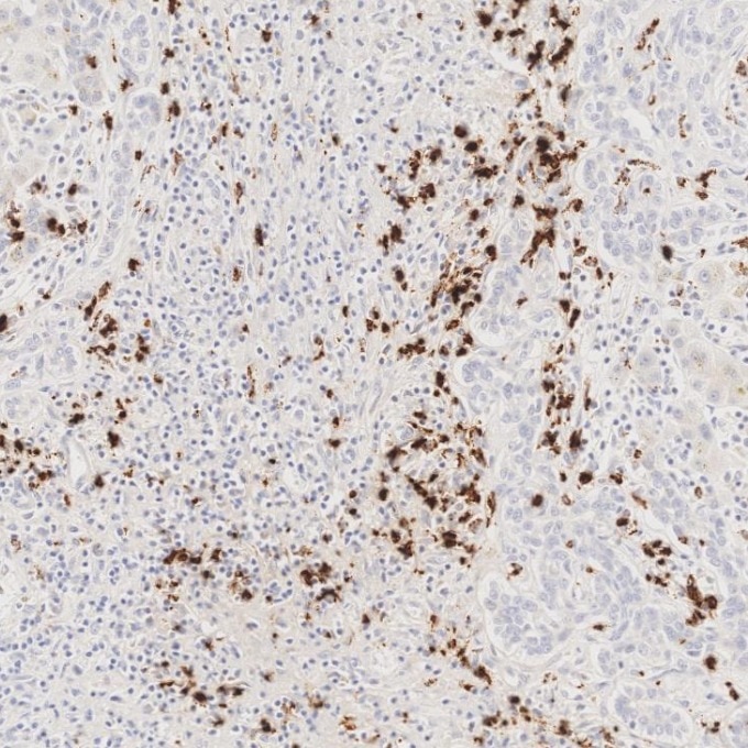 IHC staining of human liver using 81610-1-RR Immunohistochemistry (IHC) staining of human liver tissue using MPO Recombinant monoclonal antibody (81610-1-RR)
